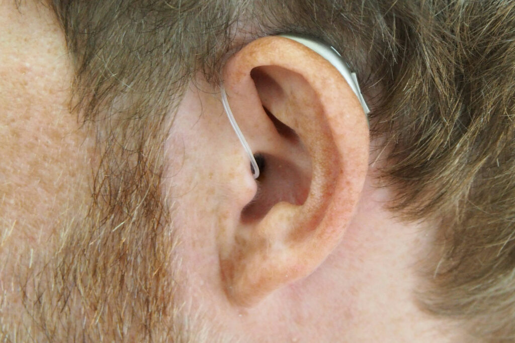 A closeup of a hearing aid stealthily in a listener's ear canal.