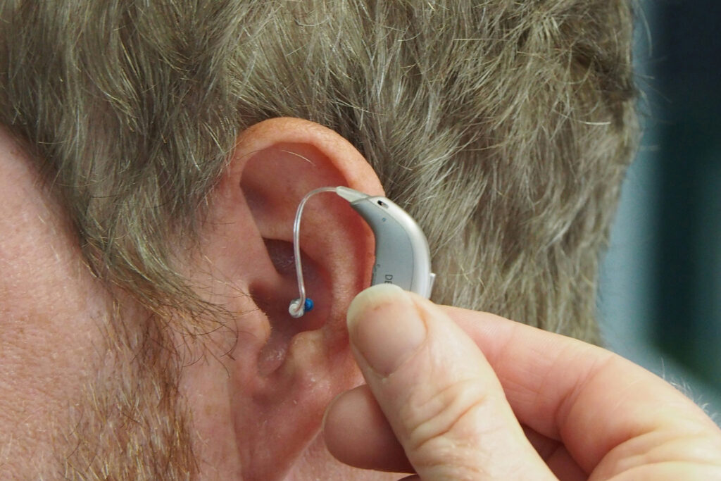 A hearing aid isn't going to likely help Tinnitus