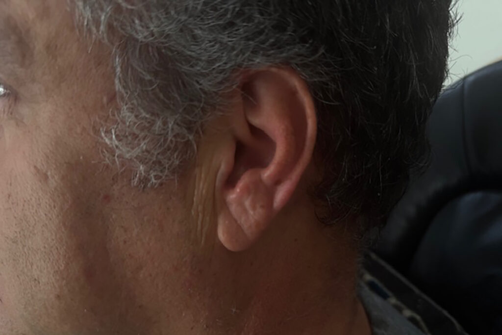 Inner-ear waxing is a new trend among audiophiles?