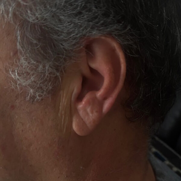 Inner-ear waxing is a new trend among audiophiles?